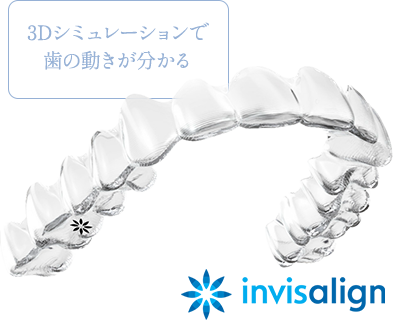 3Dシミュレーションで歯の動きが分かる