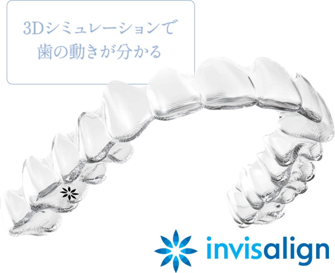 3Dシミュレーションで歯の動きが分かる